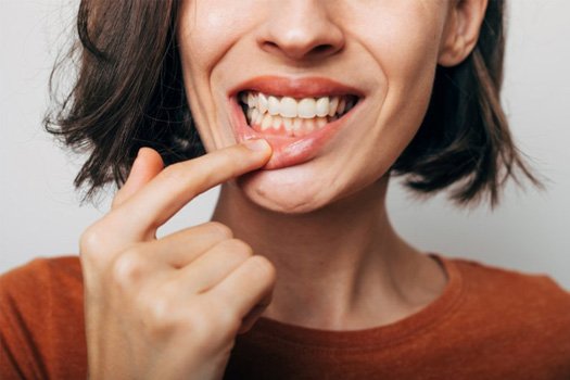 a woman showing signs of gum disease