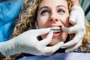 Dentist fitting Invisalign aligner over patient's teeth.